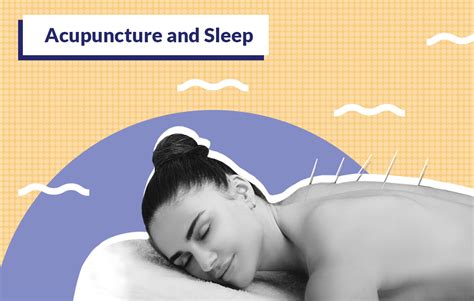 The Benefits Of Acupuncture For Quality Sleep Sleepopolis