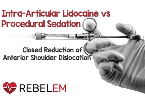 Intra Articular Lidocaine Vs Procedural Sedation And Analgesia For