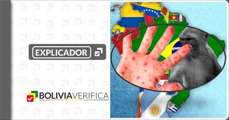 Viruela del mono en América Latina cinco países ya confirmaron casos Bolivia Verifica