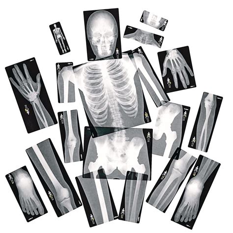 Human X Rays Set Of 18