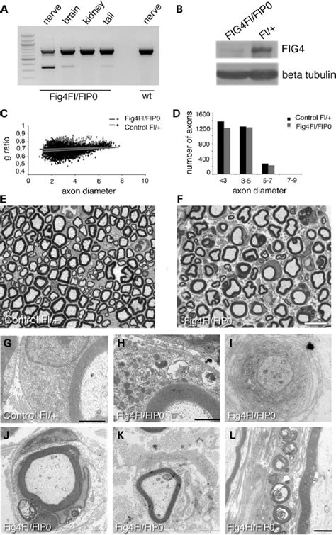 Schwann Cell Conditional Ablation Of Fig Causes Developmental