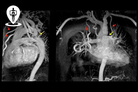 Risonanza Magnetica Con Contrasto Radiologia Italia