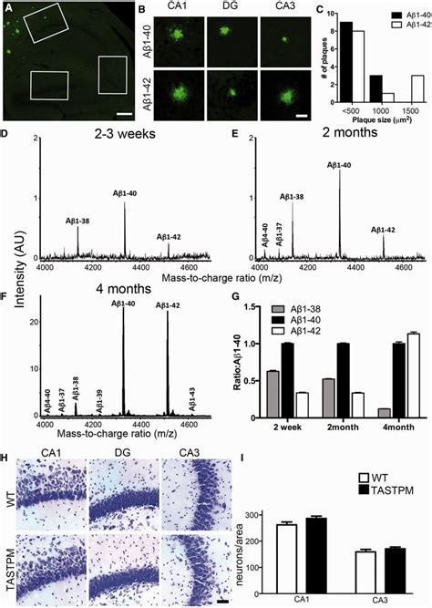 Amyloid β hippocampal plaque loads and neuronal counts in 4 month old