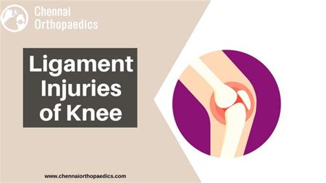 Ligament Injuries Of Knee Ppt