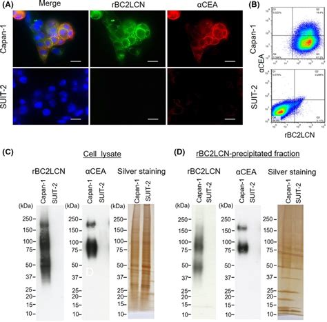 Carcinoembryonic Antigen Cea Is A Glycoprotein Ligand Of Rbc Lcn In