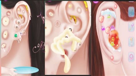 Asmr Ear Wax Cleaning Video Ear Wax Cleaning Salon Ear Wax Cleaning