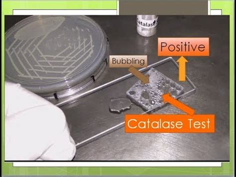 Catalase Test Positive Catalase Test Most Common Test In