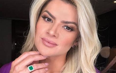 Mirella Santos relata momentos de sufoco após sofrer acidente em casa e