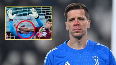 Wojciech Szczęsny we krwi Potężny cios w nos TVP SPORT