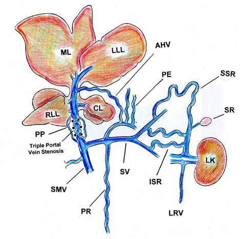 Inflammation A Way To Understanding The Evolution Of Portal