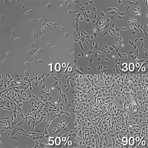 Anyone Have Pictures Of Confluency Levels For Cell Culture Rlabrats