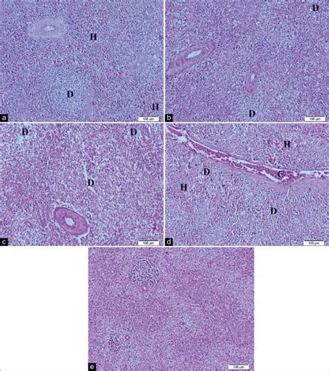 Representative Photomicrographs Of Spleen Histopathology A