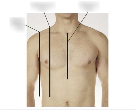 Reference Lines For Anterior Chest Diagram Quizlet