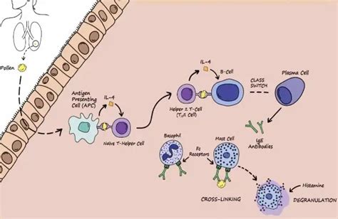 Type 1 Hypersensitivity - Pathogenesis and Clinical Menifestations ...