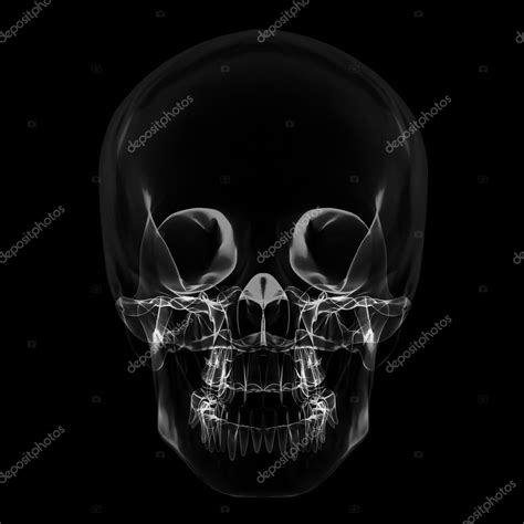 X-ray skull — Stock Photo © yodiyim #117543600