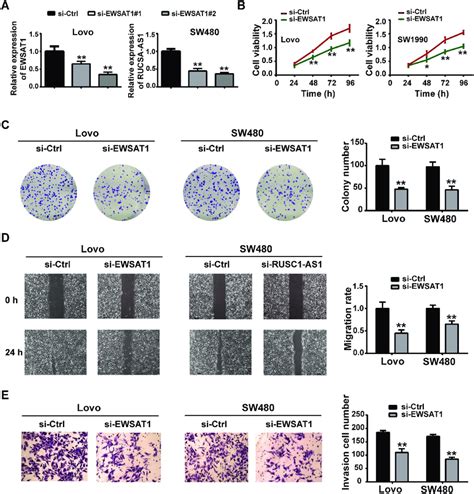 Knockdown Of Ewsat Inhibited The Proliferation Migration And Invasion