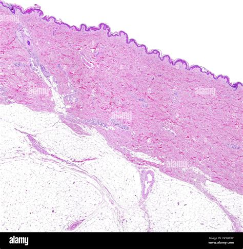 Section Dermis Micrograph Hi Res Stock Photography And Images Alamy