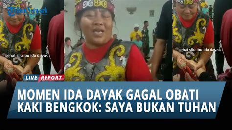 Gagal Obati Kaki Bayi Yang Tulangnya Bengkok Ida Dayak Saya Bukan