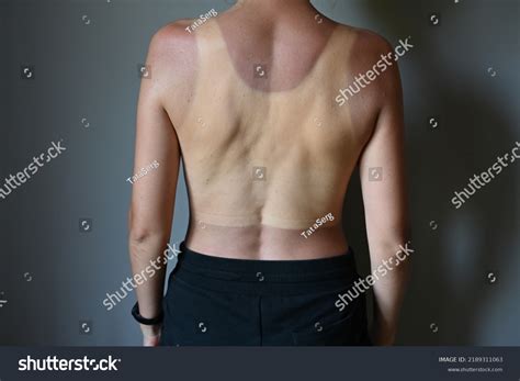 Cierre De Una Joven Mujer Desnuda Foto De Stock Shutterstock