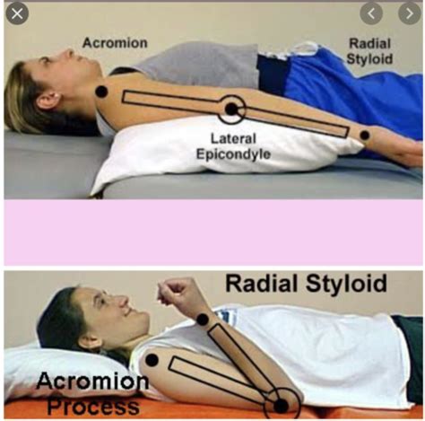 Goni Elbow Flexion Extension Flashcards Quizlet