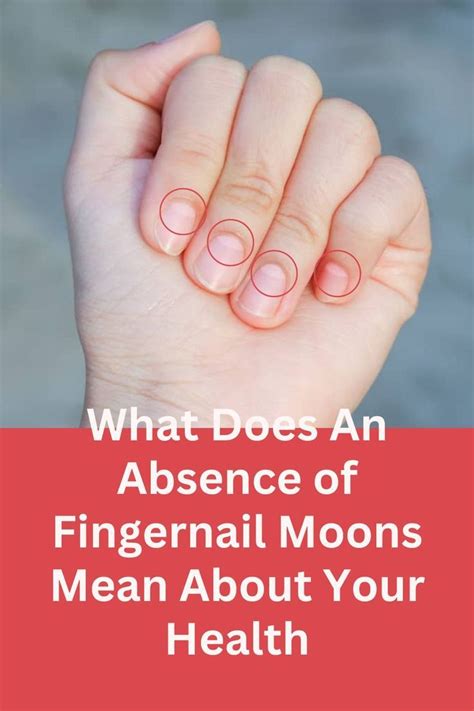 Understanding Fingernail Moons Meaning And Health Indicators