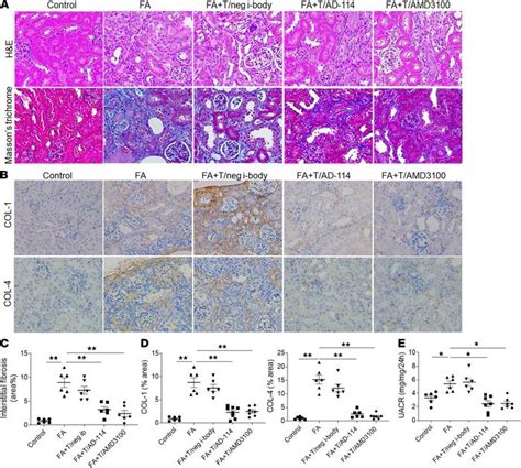 JCI Insight A Single Domain I Body AD 114 Attenuates Renal Fibrosis