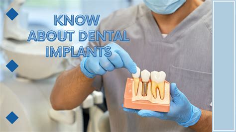 Discover Some Important Facts About Dental Implants