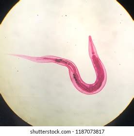 281 imágenes de Enterobius vermicularis Imágenes fotos y vectores de