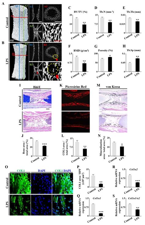 Dysbacteriosis Derived Lipopolysaccharide Causes Embryonic Osteopenia