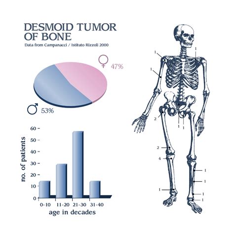 Desmoplastic Fibroma