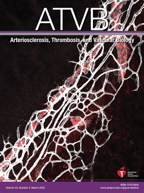 Medial Arterial Calcification A Significant And Independent