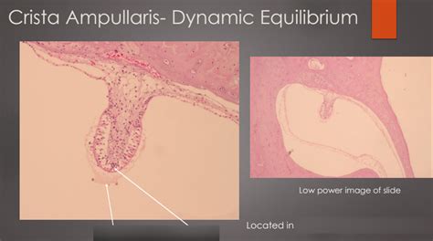 Crista Ampullaris Dynamic Equilibrium Diagram | Quizlet