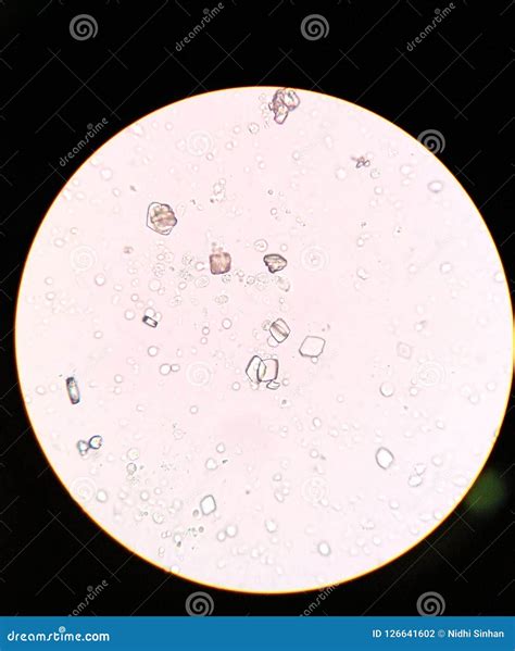 Uric Acid Crystals In Urine Stock Photo Image Of Urine Microscopic