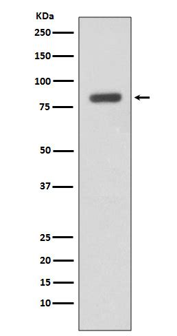 Ikk Beta Antibody