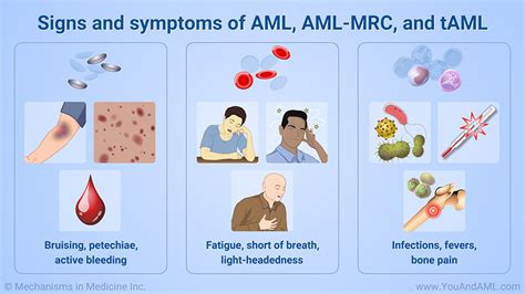 Slide Show Diagnosing Aml Aml Mrc And Taml