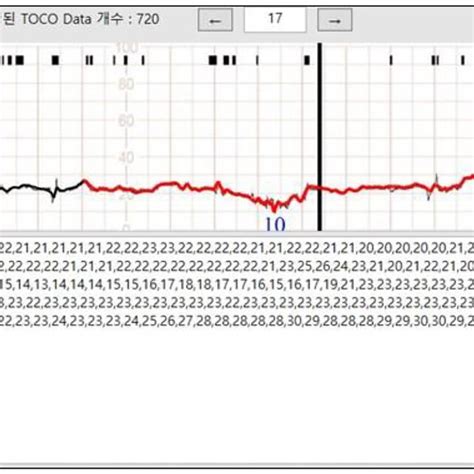 Uterine Contraction Data Pre Processed Download Scientific Diagram