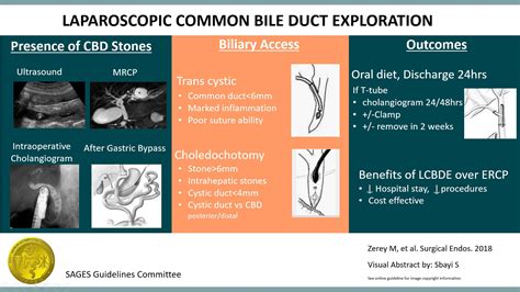 Clinical Spotlight Review Laparoscopic Common Bile Duct Exploration A Sages Publication