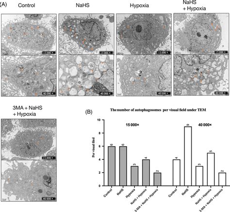 Autophagosome Detection Under Tem A The Number Of Autophagosomes