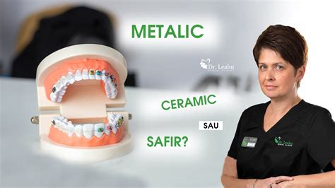 Metalic Ceramic Sau Safir Ce Aparat Dentar Fix Este Mai Bun