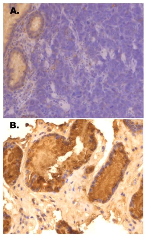 Representative Tff Immunohistochemical Staining Results For A A