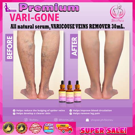 BEST SELLER PREMIUM VARI GONE VARICOSE VEINS ALL NATURAL SERUM