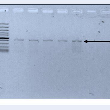 Gel Image Of P Falciparum Kelch Propeller Gene Bp Amplification