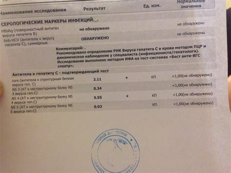 Анализ Мор Что Это За Анализ - 56 Фотo