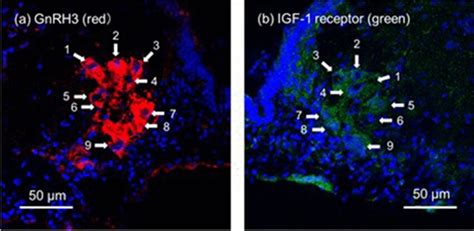 Representative Images Of Gonadotropin Releasing Hormone Gnrh