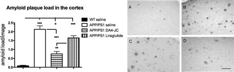 Quantification Of Beta Amyloid Plaque Loads In The Neocortex A 1 Way