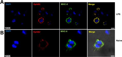 EphB2 Co Localizes With MHC II On BMDCs Two Examples Are Shown A