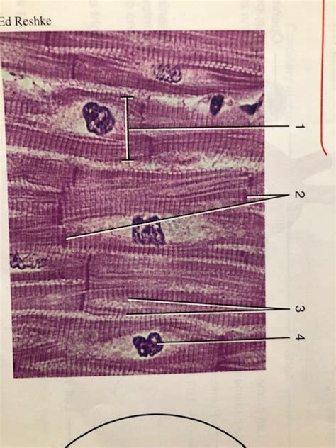 Figure 27 9 Photomicrograph Of Cardiac Muscle Fibers Diagram Quizlet