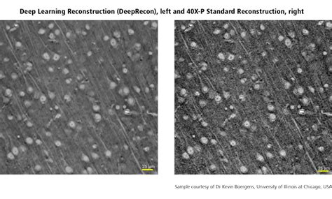 Ai Powered X Ray Microscope Reconstruction Technologies