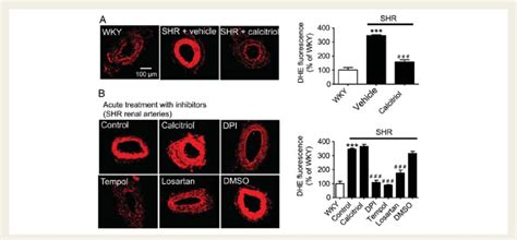 Chronic In Vivo Treatment With Calcitriol Decreases The Reactive Oxygen