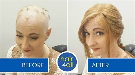 How To Apply Attach A Non Surgical Hair Replacement System For Women With Our Client Charlotte